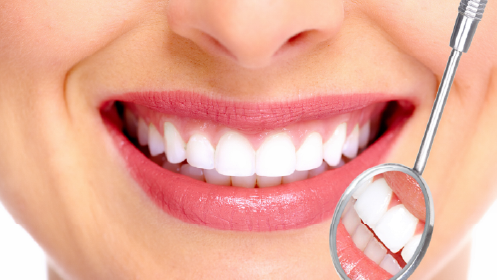 Un 81% de descuento en tu limpieza en Dentalios