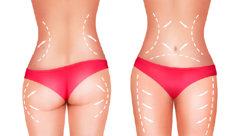 Completo tratamiento detox purificante cuerpo entero