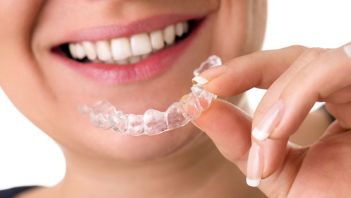 Férula de descarga Michigan para aliviar la tensión dental