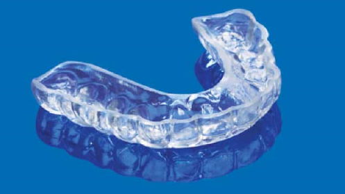 Alivia la tensión dental con la férula de descarga Michigan