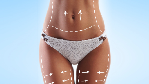 Plan reductor con 5 de presoterapia y 5 masajes drenantes