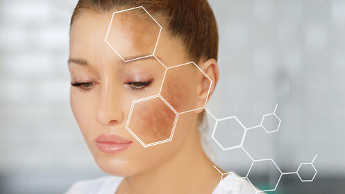 Tecnología Plasma Pen: elimina 5 verrugas planas o estéticas